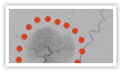 Embolization